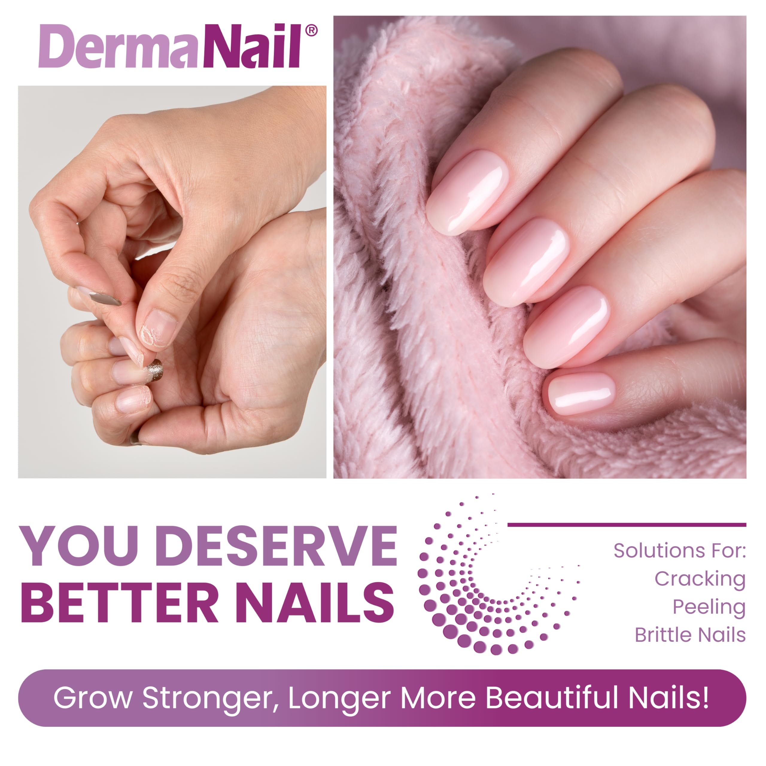 DermaNail cuticle cream tube moisturizes cuticles for healthier skin.