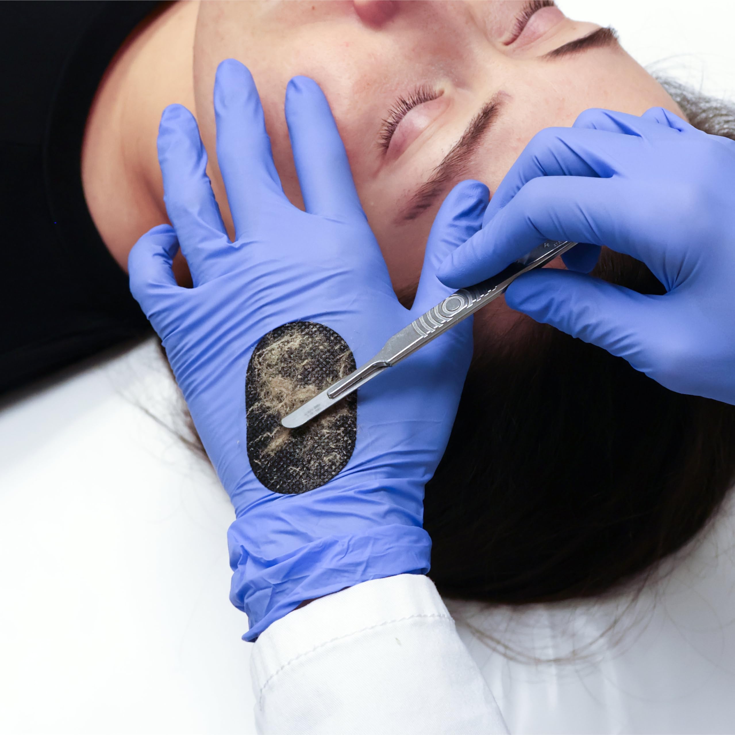 DermaPad edge-clearing demonstrates maintaining a clean blade during dermaplaning.