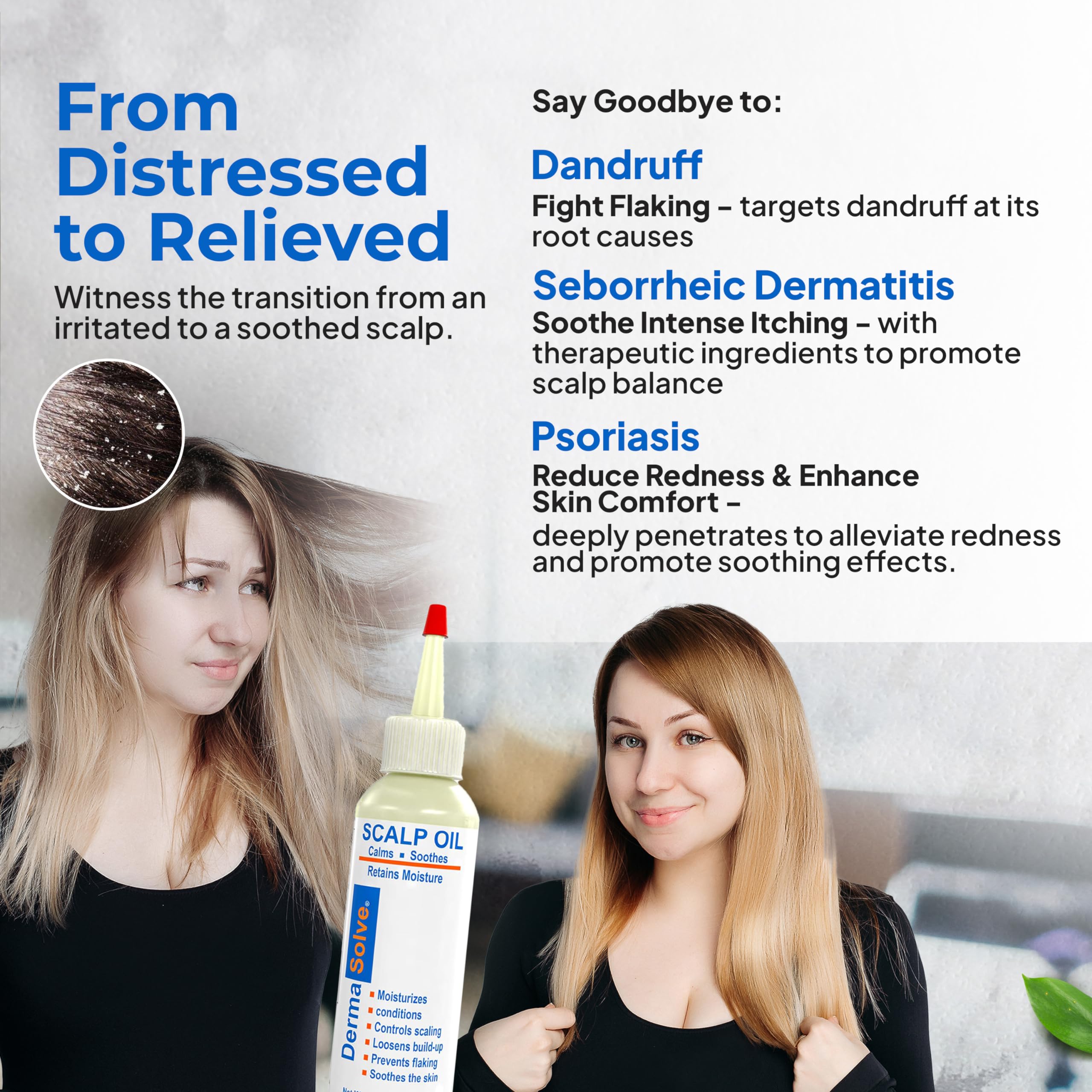Dermasolve chamomile extract close up on scalp