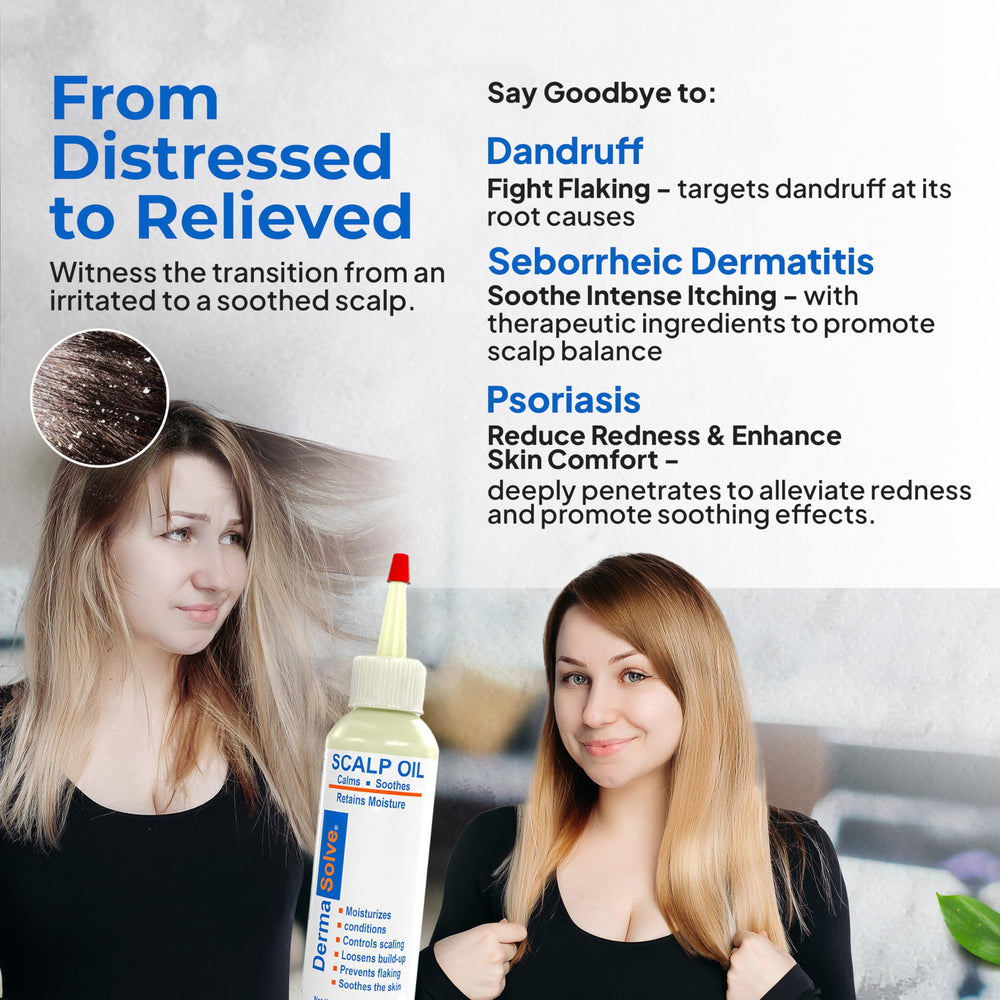Dermasolve chamomile extract close up on scalp