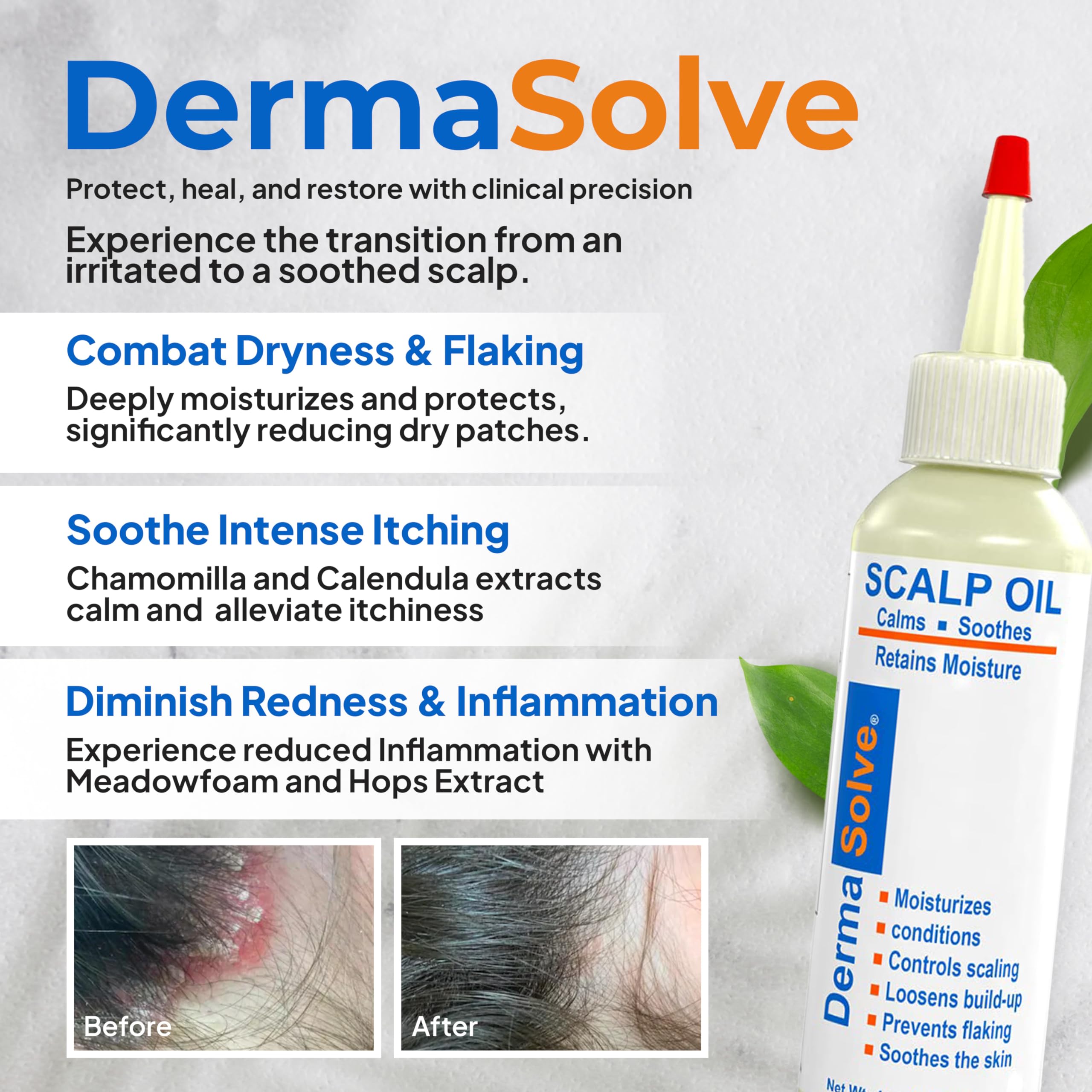 Dermasolve psoriasis oil ingredient display on label