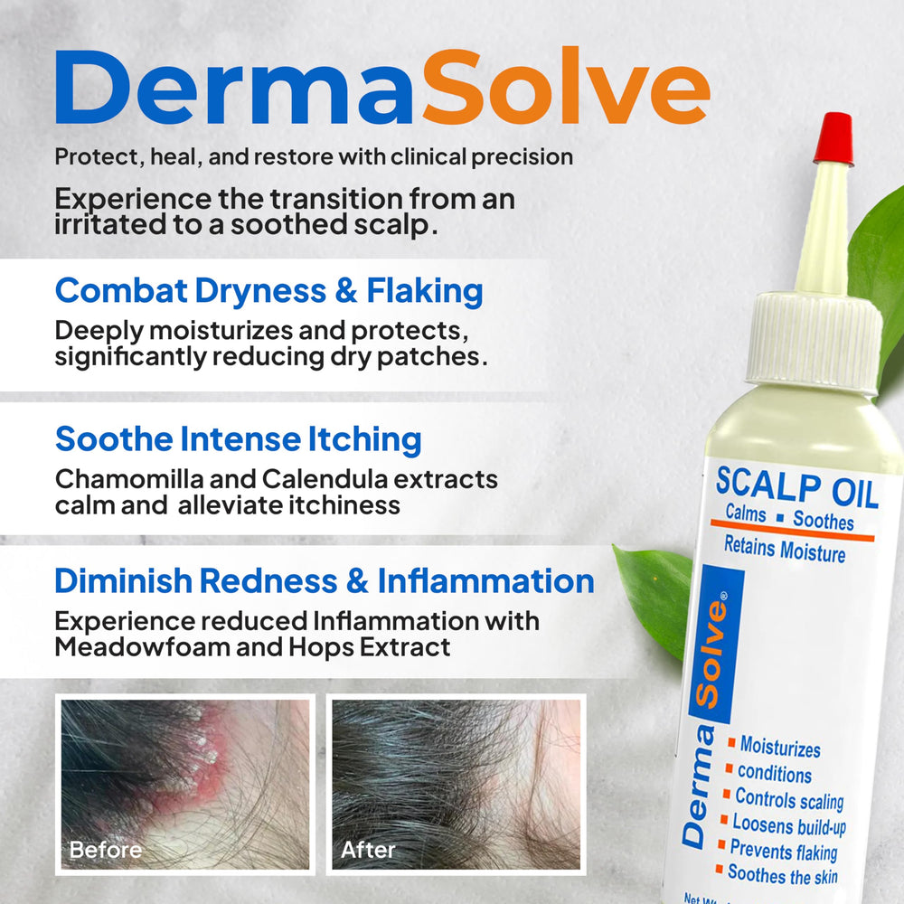 Dermasolve psoriasis oil ingredient display on label