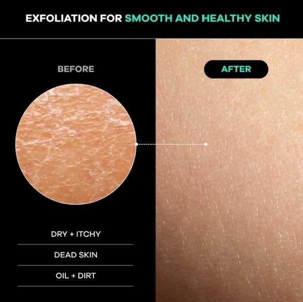 Dermasuri-material-viscosa-sin-silicona: exfoliación suave y sin irritación