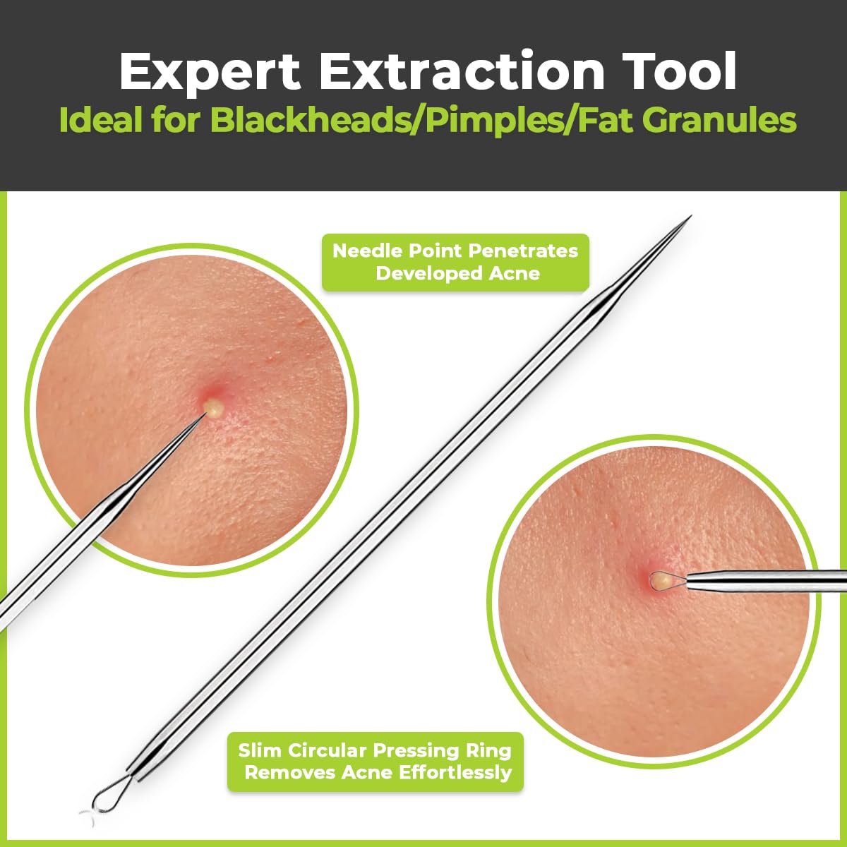 DERMATED 410 stainless steel pimple tool set, rust-resistant and easy to sterilize.