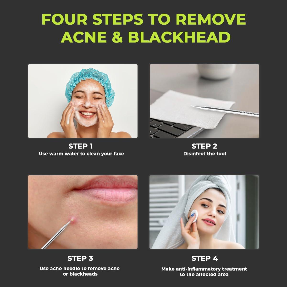 DERMATED dual-ended precision tools for effective blackhead and whitehead extraction.