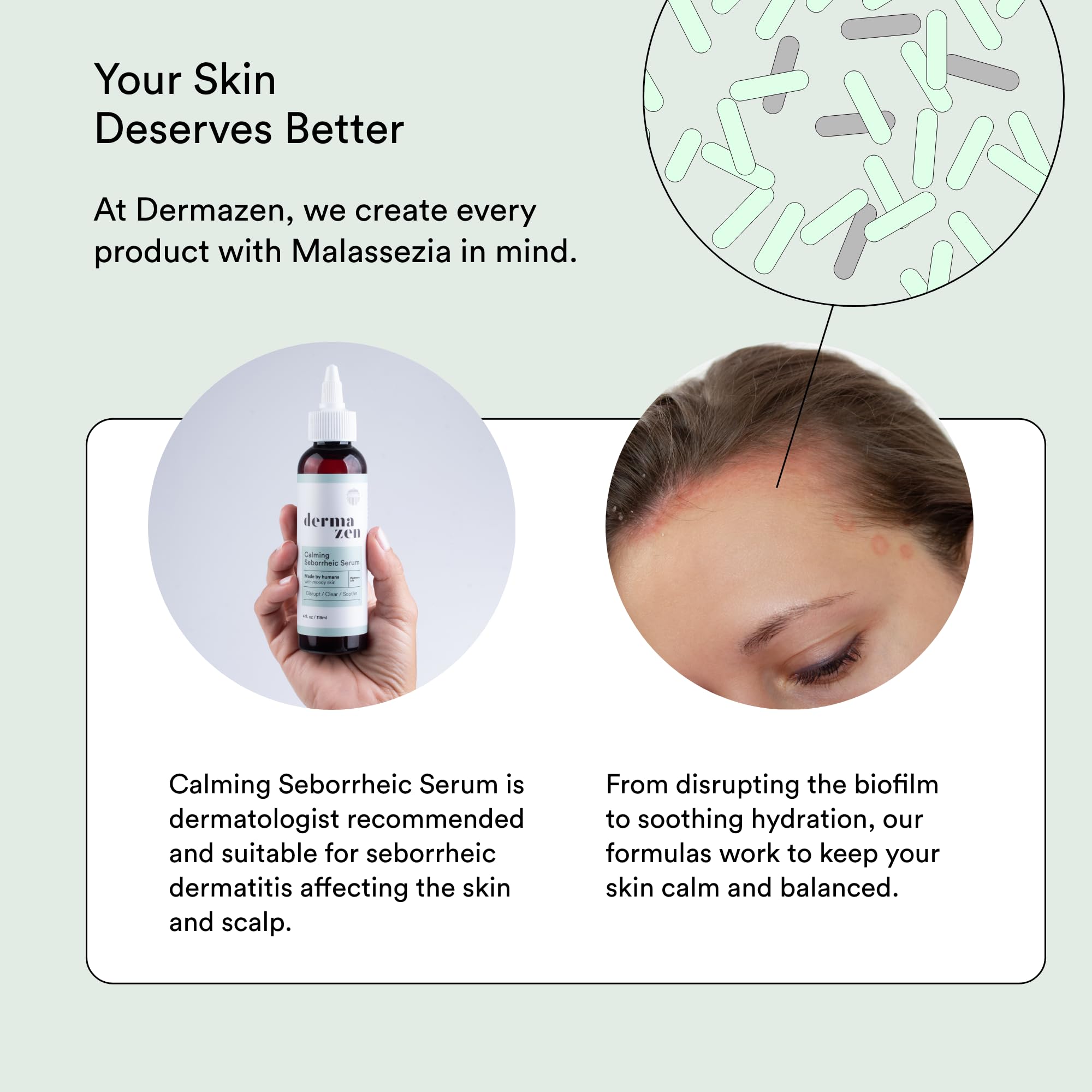 Aloe and hyaluronic acid hydrate irritated skin in Dermazen formula.
