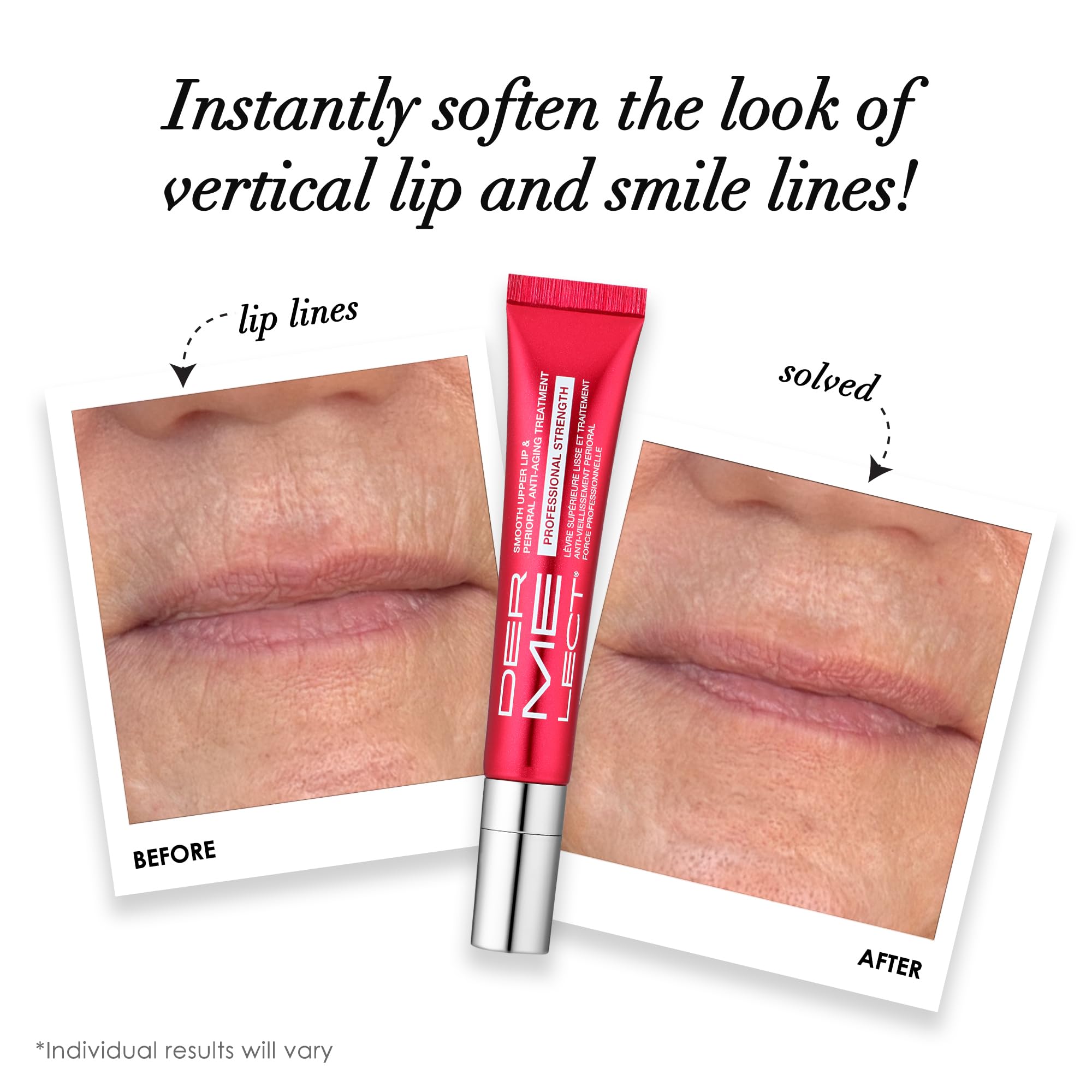 Dermelect Smooth Upper Lip application-tip enables easy, accurate lip treatment.