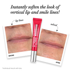 Dermelect Smooth Upper Lip application-tip enables easy, accurate lip treatment.