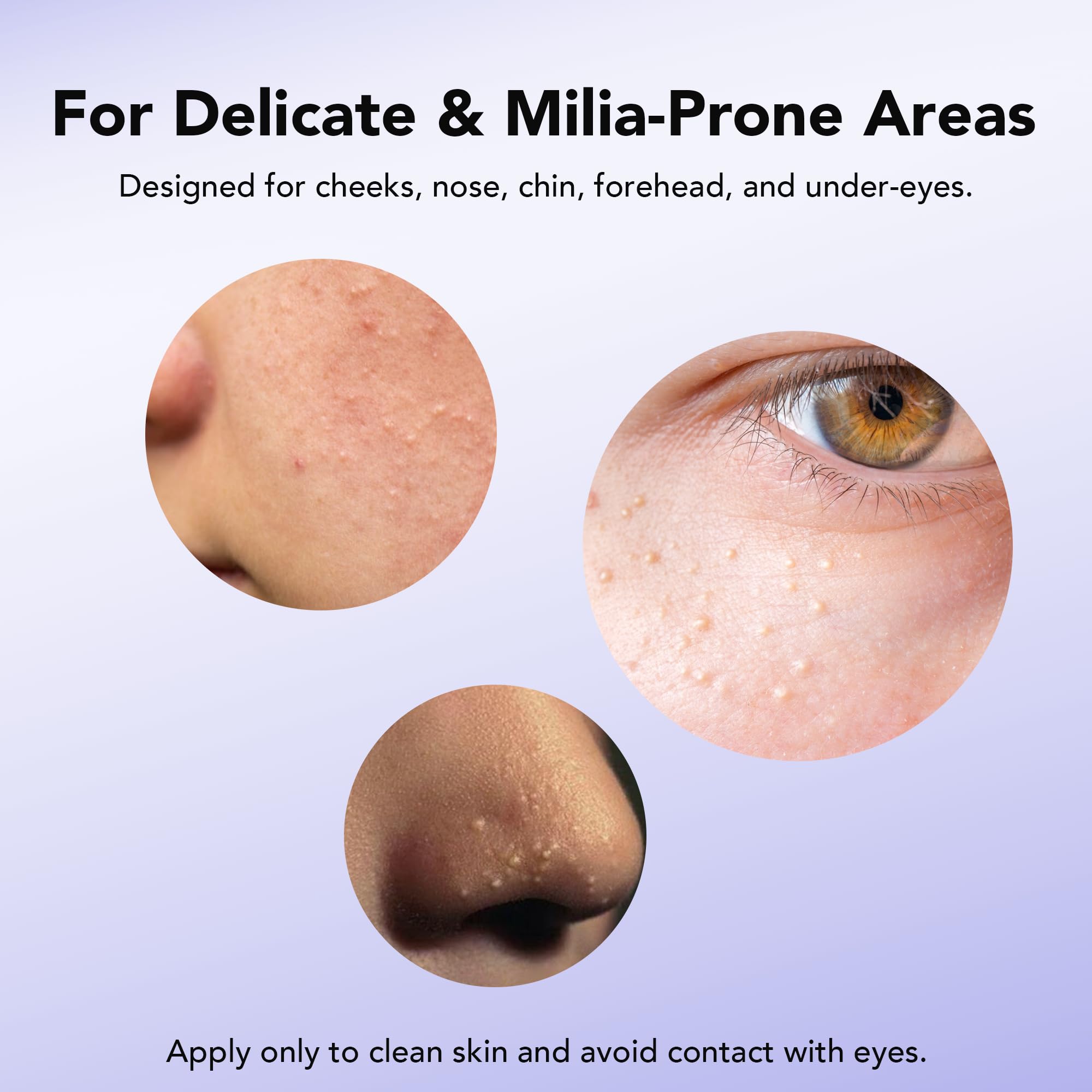 DERMFREE Milia Remover zona mejillas: suaviza gránulos cercanos a la piel