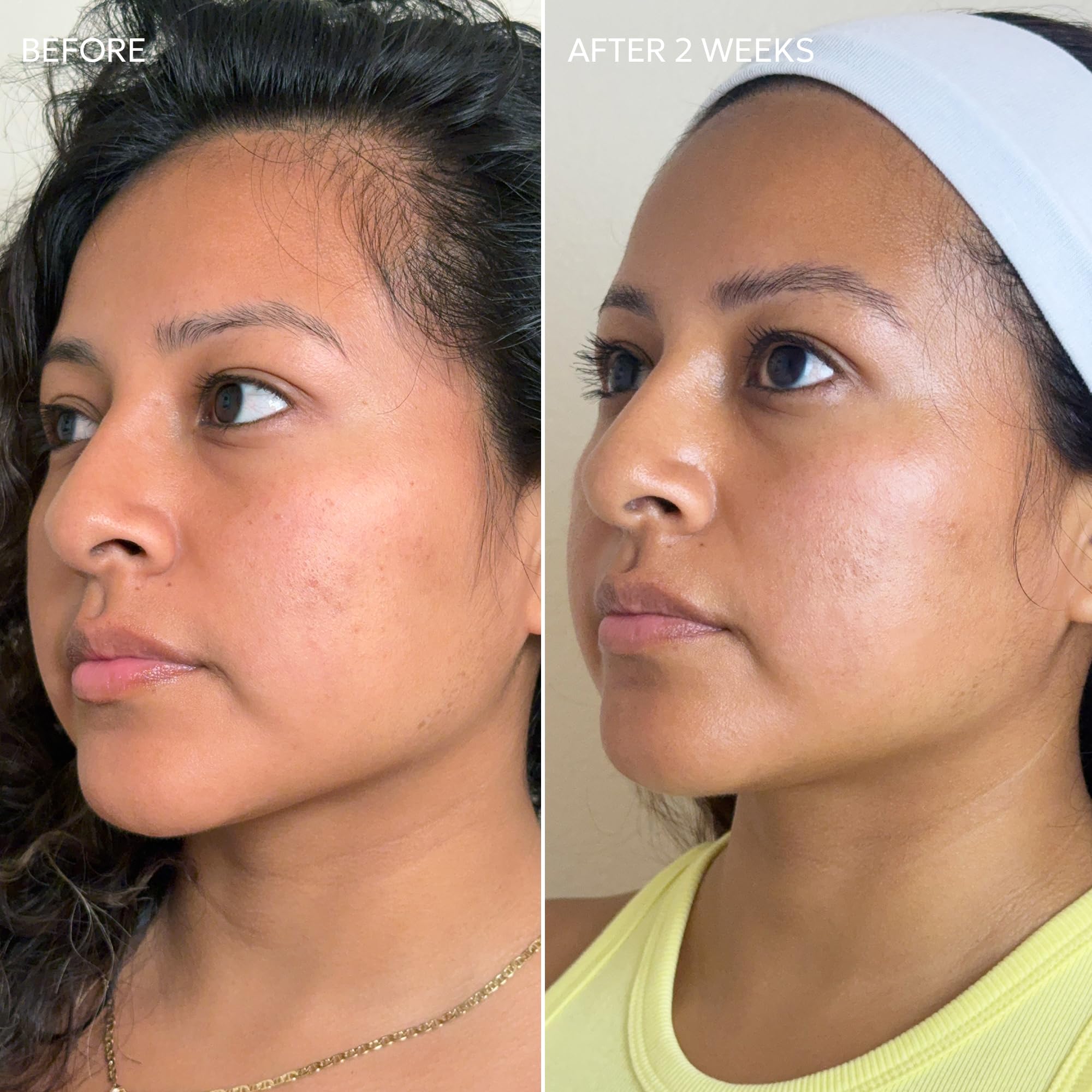 Dermisa crema para manchas: ideal tras exposición solar para tono más uniforme.