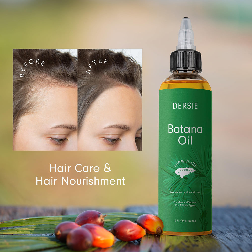 Dersie Batana Oil moisturizes hair, contributing to softness and shine.