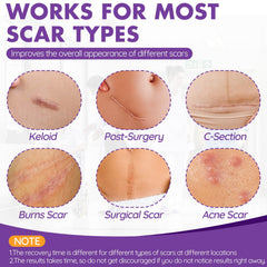 DFK silicone scar tape unrolling demonstrates flexible, gentle application