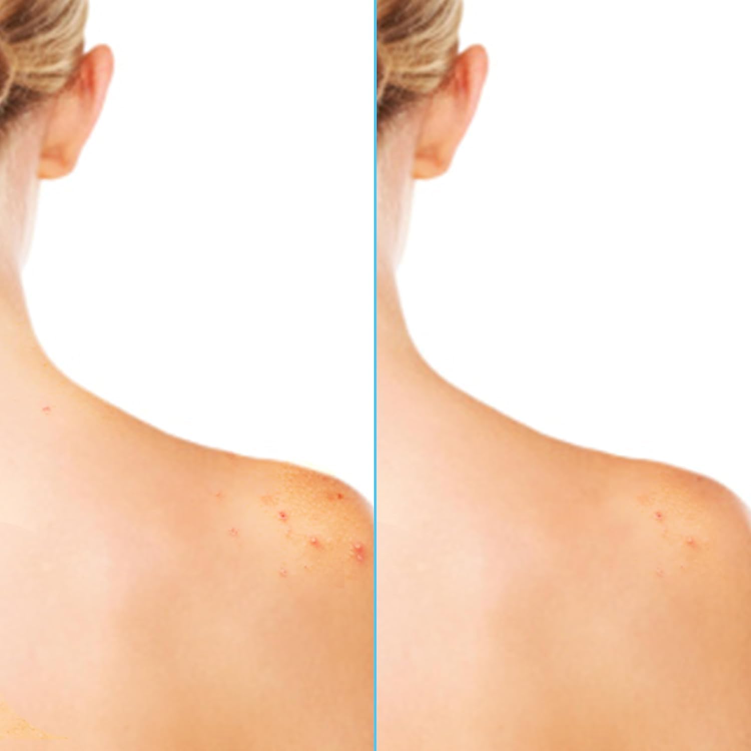 Differin Cuerpo textura sin residuo: sensación ligera tras la aplicación.