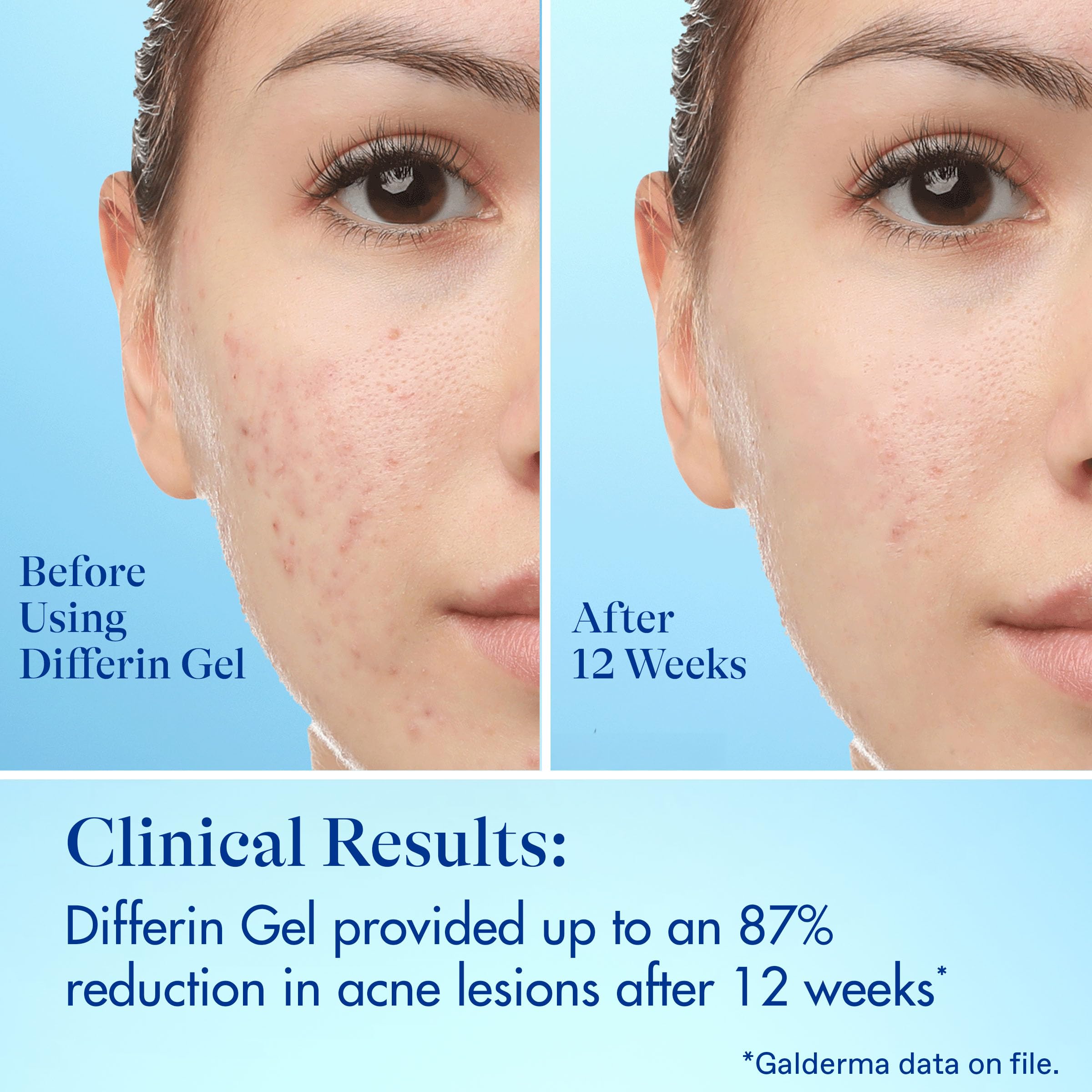 Resultados visibles en 6 horas gracias a exfoliación suave.