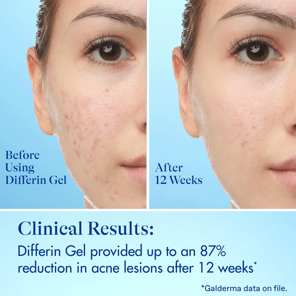 Resultados visibles en 6 horas gracias a exfoliación suave.