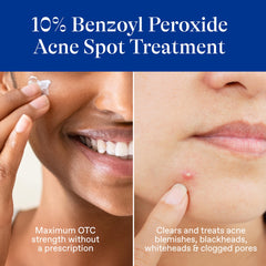 Penetracion profunda de Differin en poros para reducir imperfecciones.