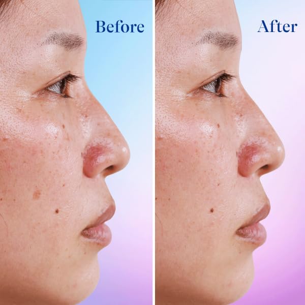 Differin Serum uso diario suave para piel sensible.