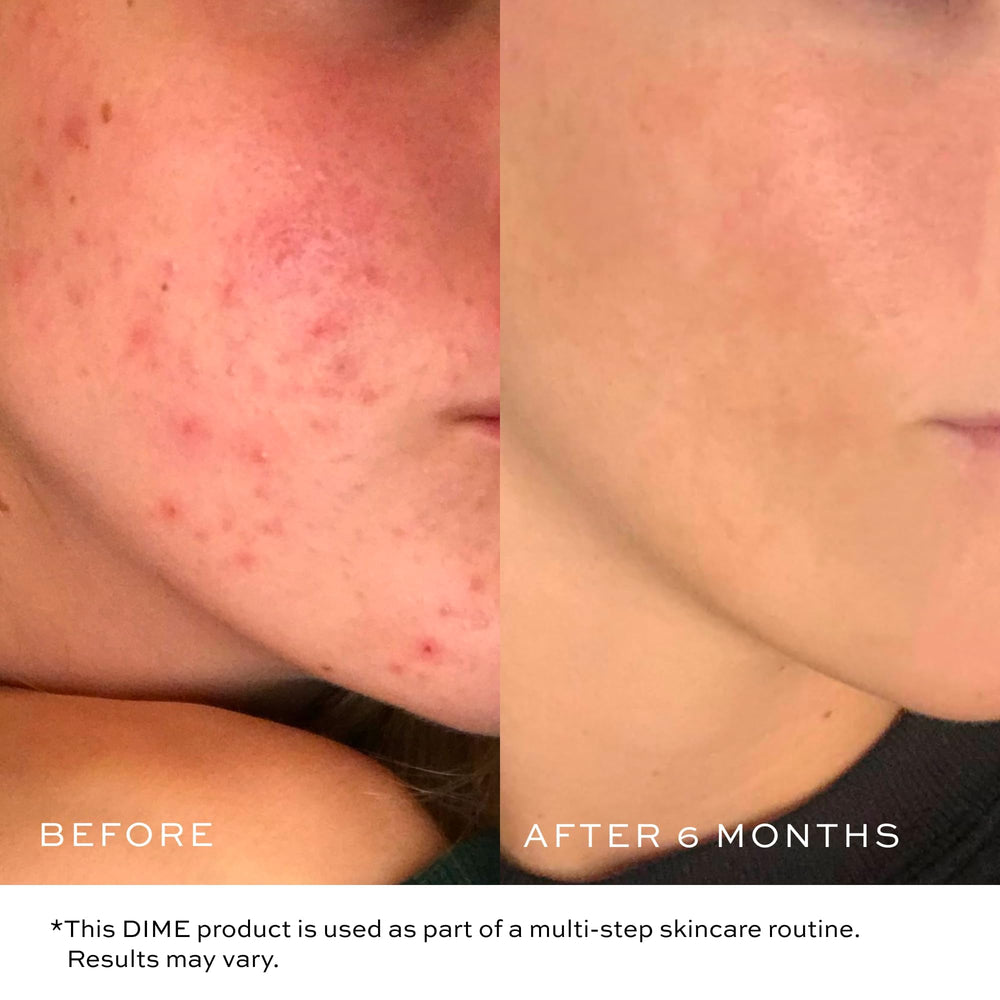 DIME Gentle Jelly Cleanser face massage demonstrates soothing cleansing routine.