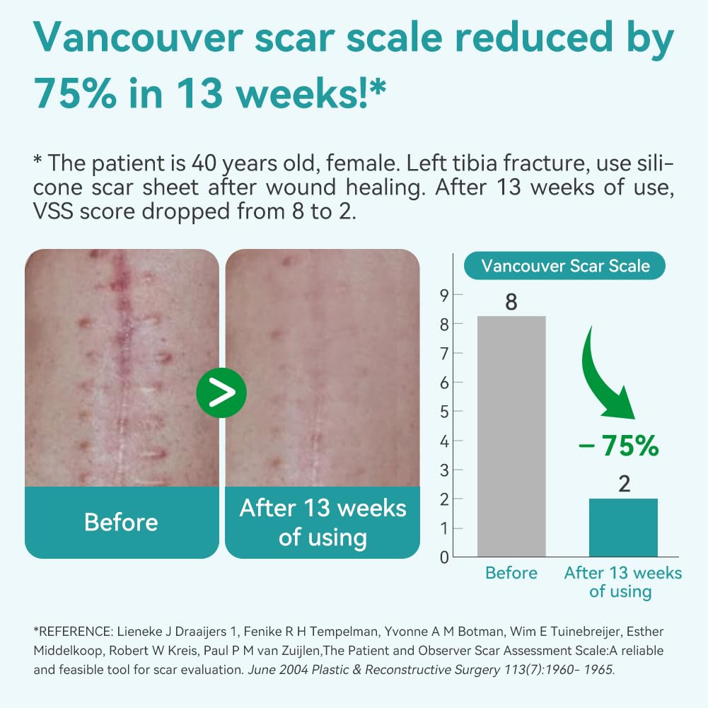 Dimora breathable ultra-soft silicone scar tape adheres well during daily activity.