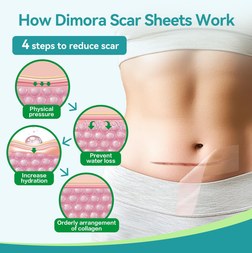 Dimora banda silicona para queloides, uso suave y seguro.