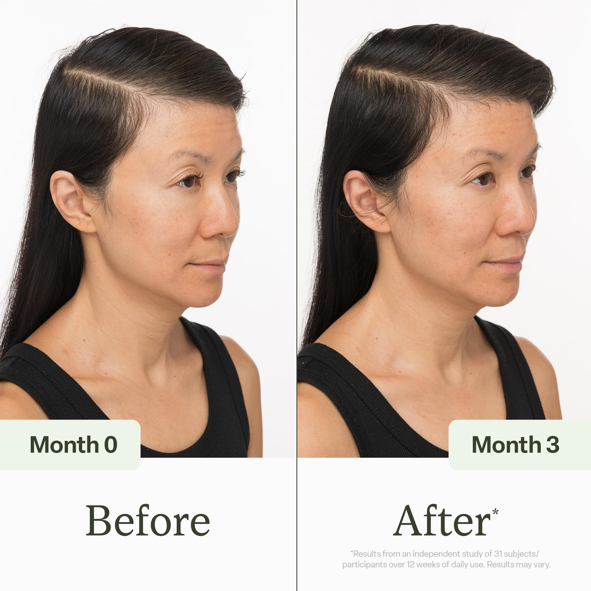 Divi hair serum tea tree oil drop highlights cleansing and buildup removal.