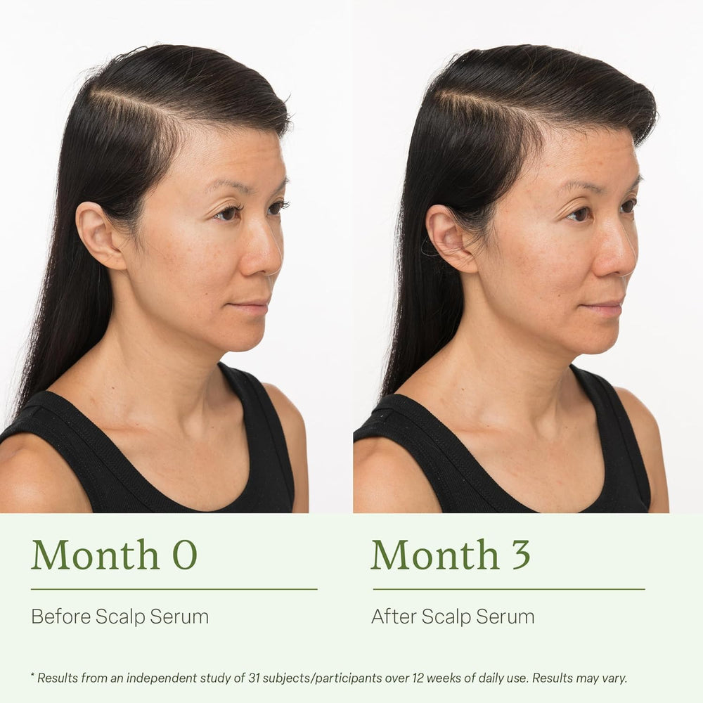 Divi Scalp Serum ingredients card features caffeine and rosemary oil.