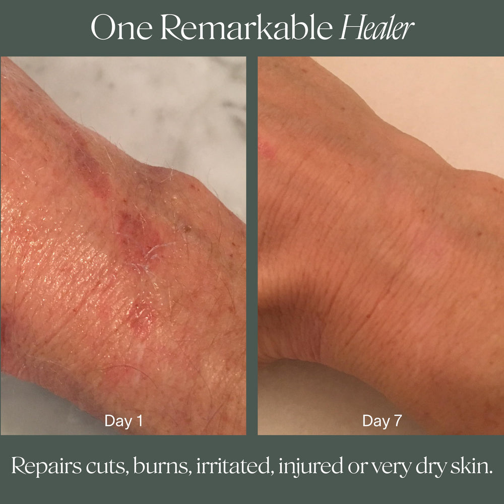 Doctor Rogers Restore ingredients label highlighting hypoallergenic vegan formula.