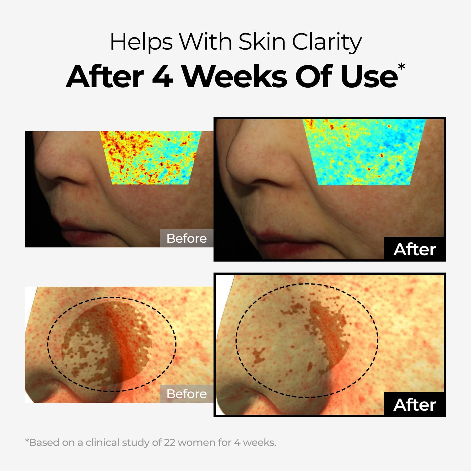 Clinical study notes pigmentation improvement with DOMINAS Brightening Complex