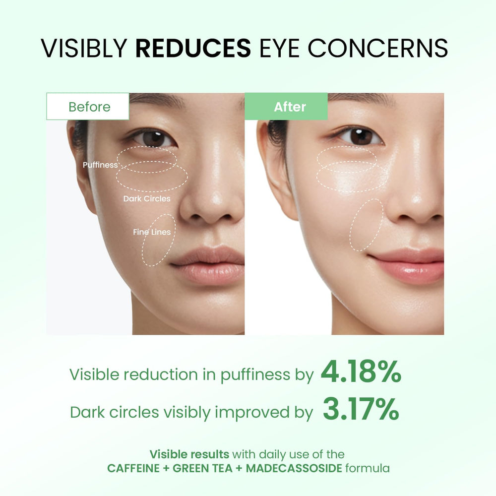 Rodillo 360° de Dongyu para absorción suave y masaje relajante