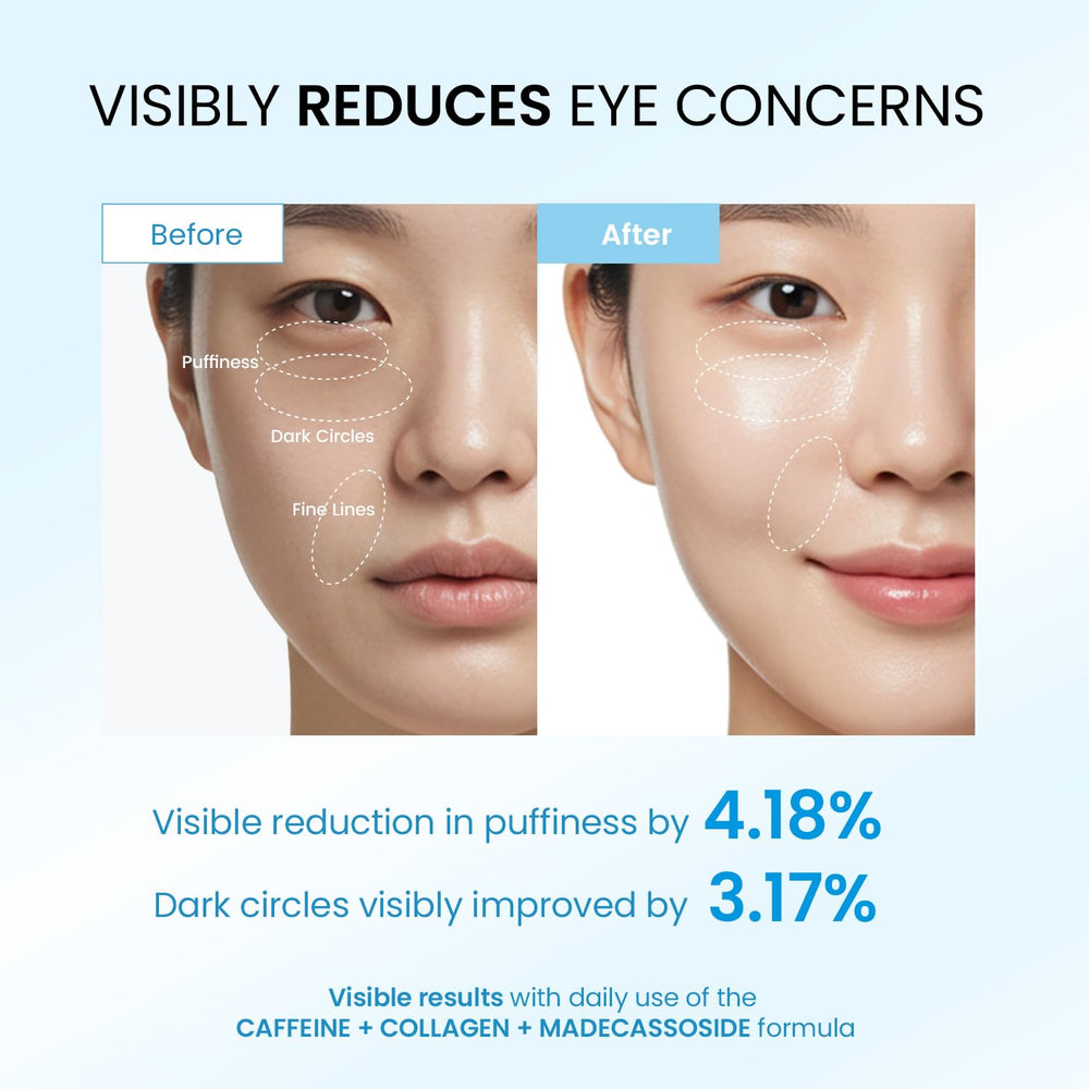 Dongyu under-eye rollerball in use provides cooling puffiness relief