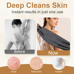DOUNIU Blissal two-sides design enables gentle daily care and targeted exfoliation