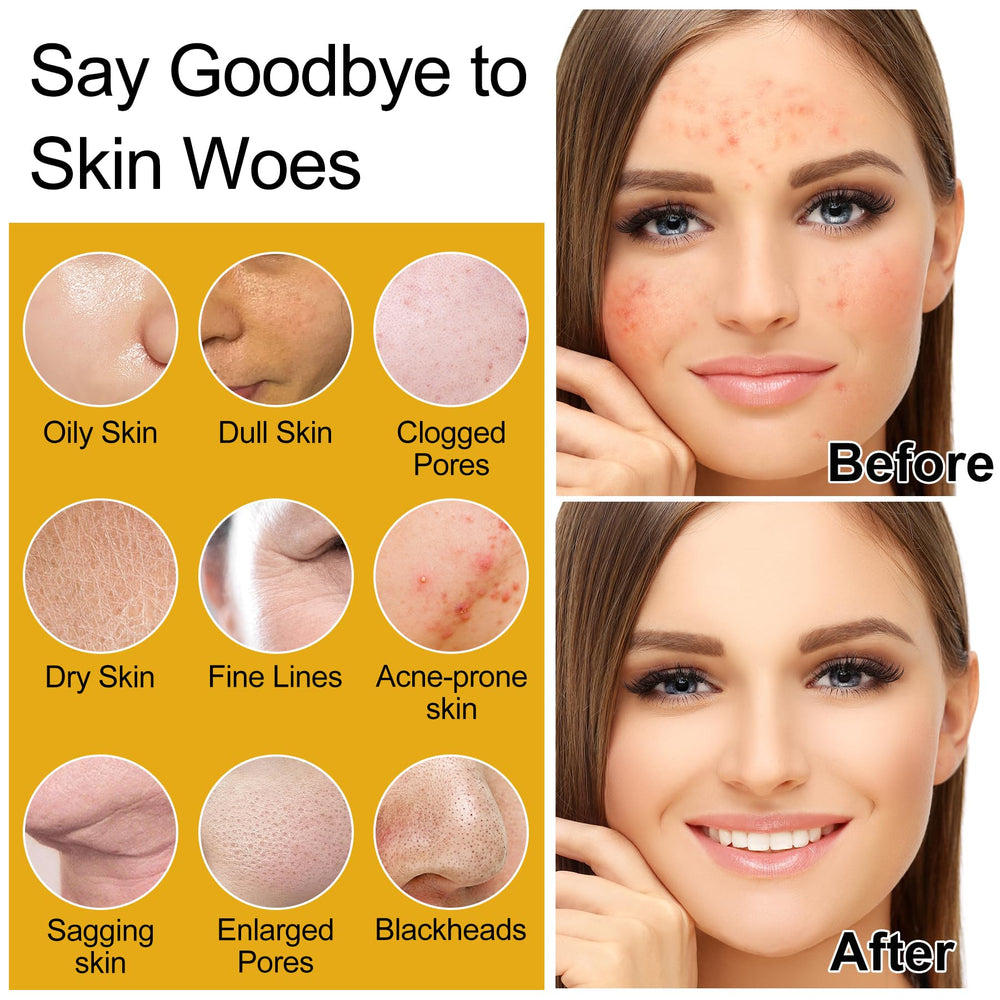 DOYEEWO limpiador facial en espuma ofrece limpieza suave y profunda