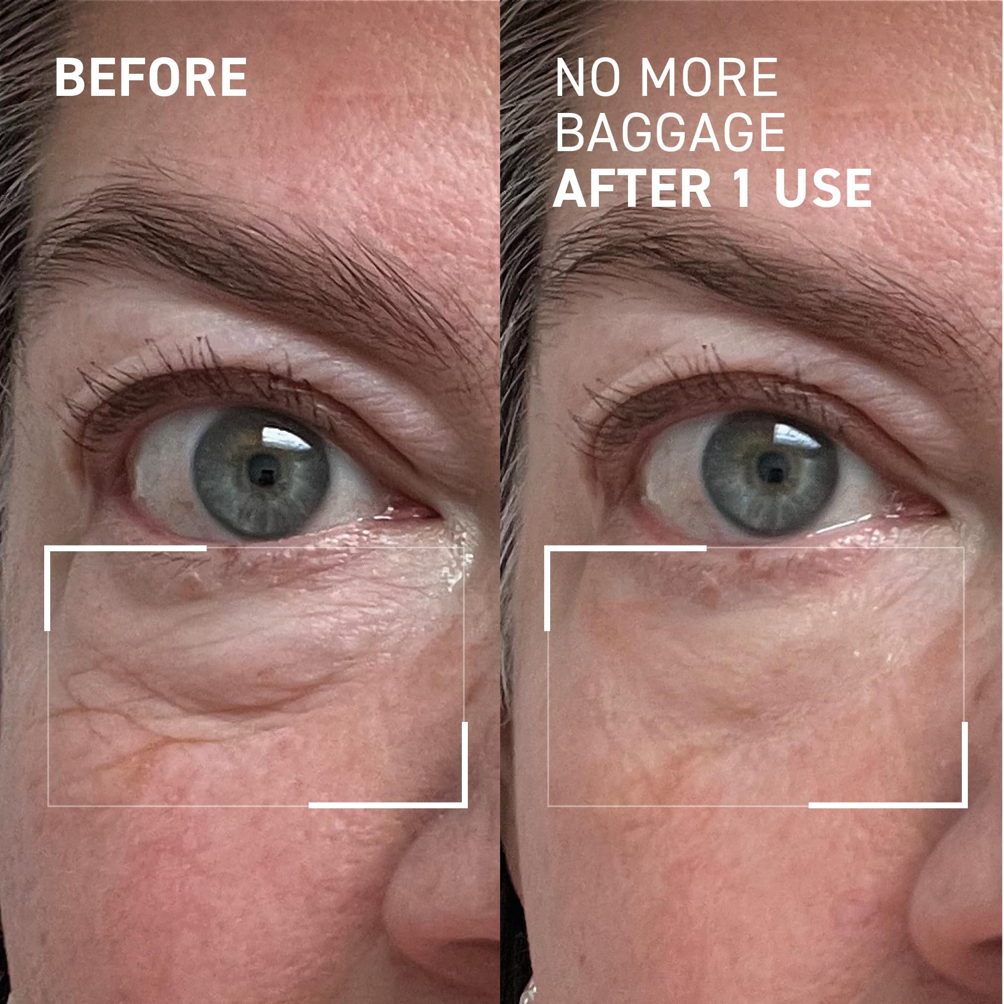 Dr. Brandt Needles No More Baggage warming with fingertips for gentle absorption.