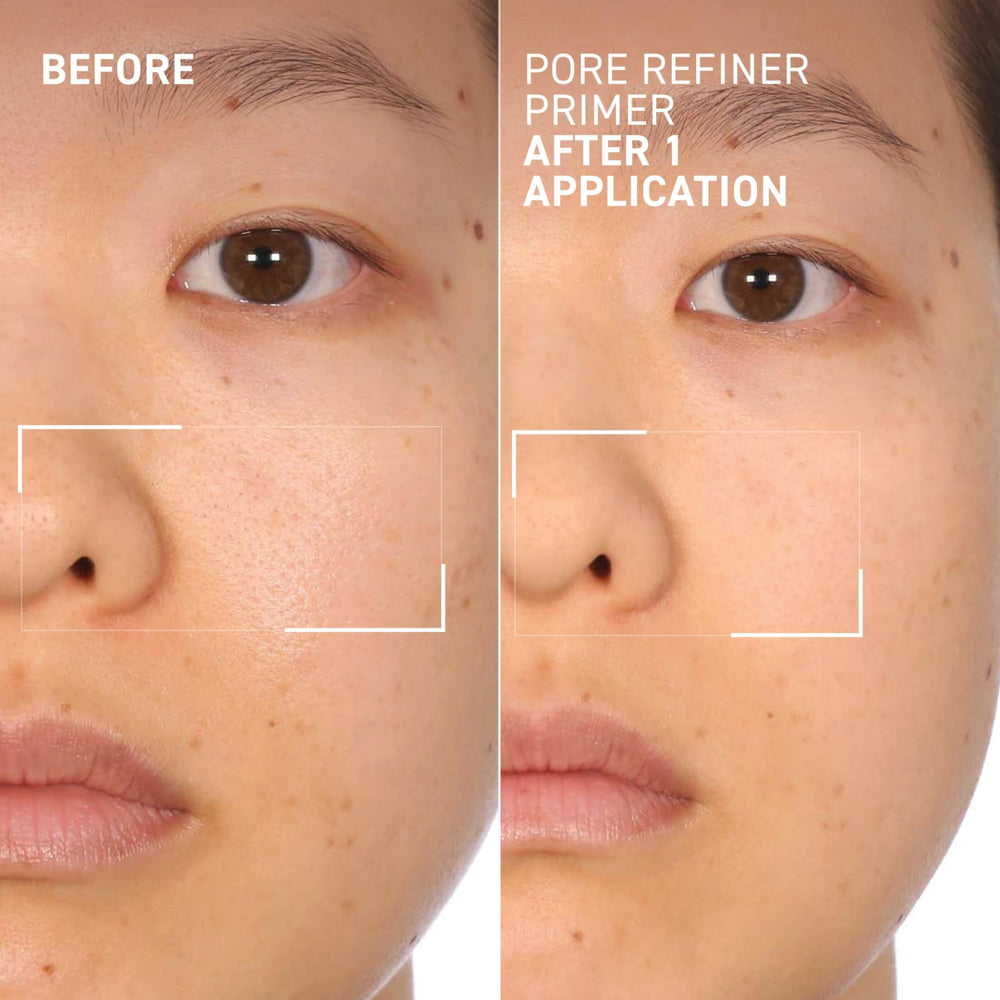 Dr. Brandt Pores No More Primer ingredient spotlight salicylic acid refines pores