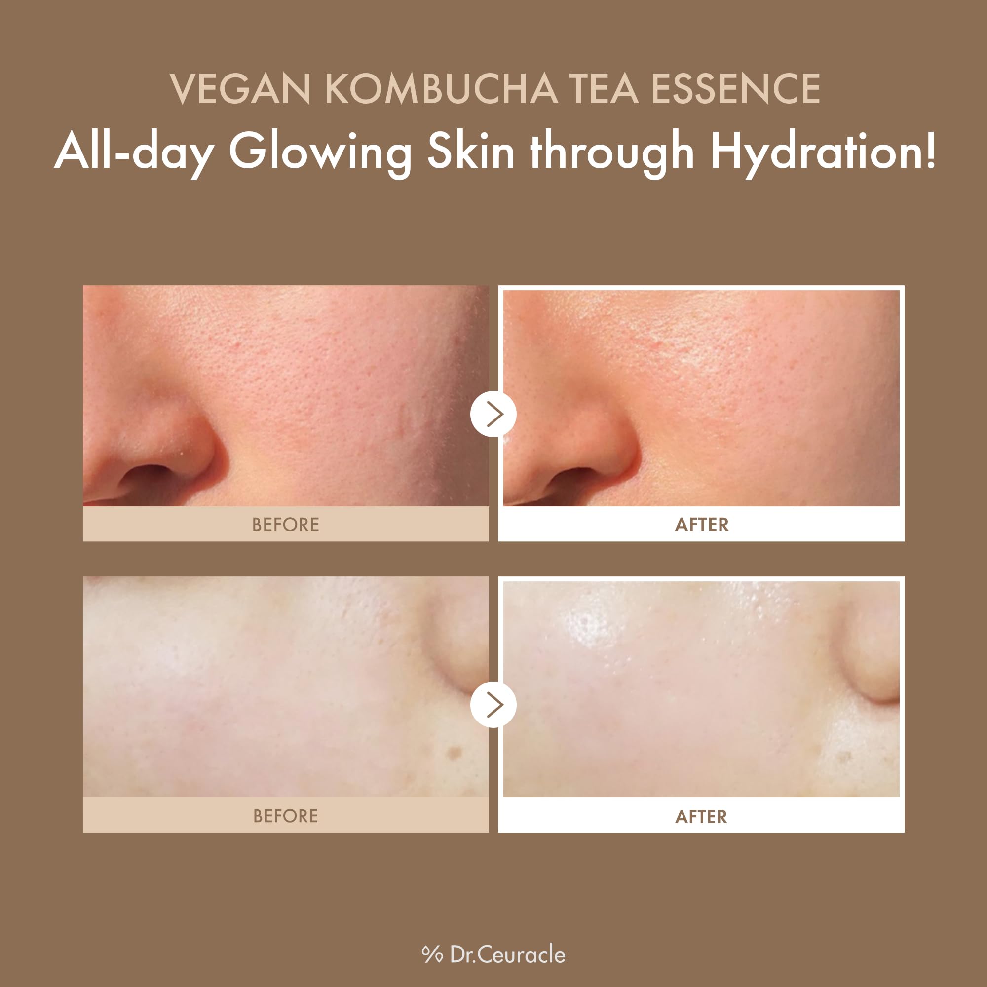 Dr.Ceuracle Kombucha Tea Extract visual showing probiotic-inspired hydration and glow.