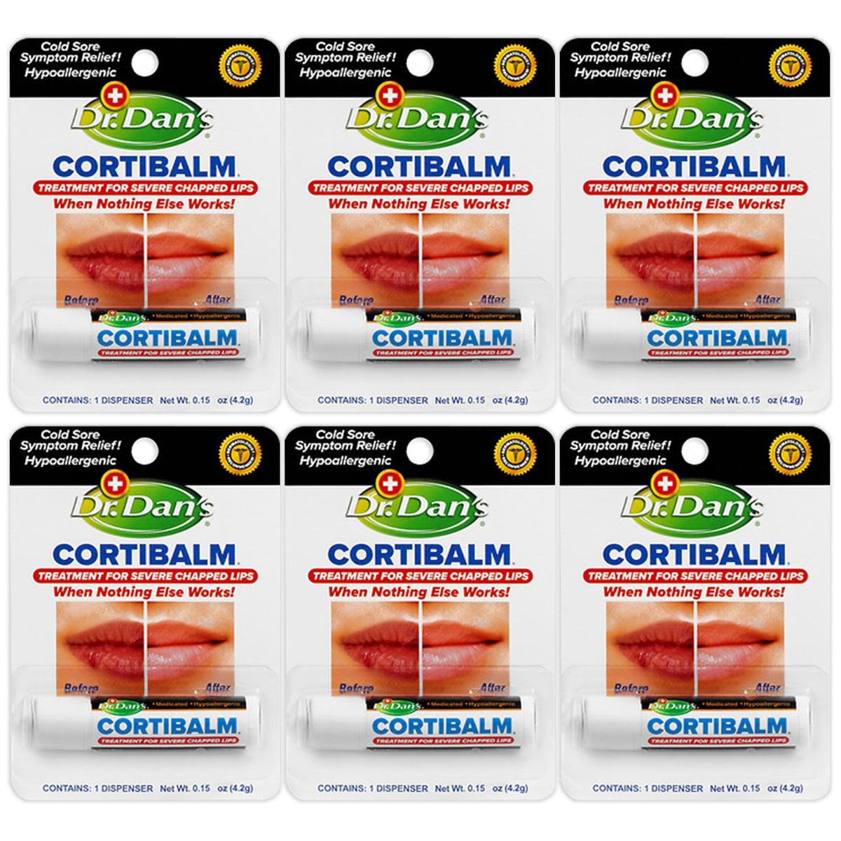 Dr. Dan's Cortibalm 6-pack for chapped lips provides soothing relief.