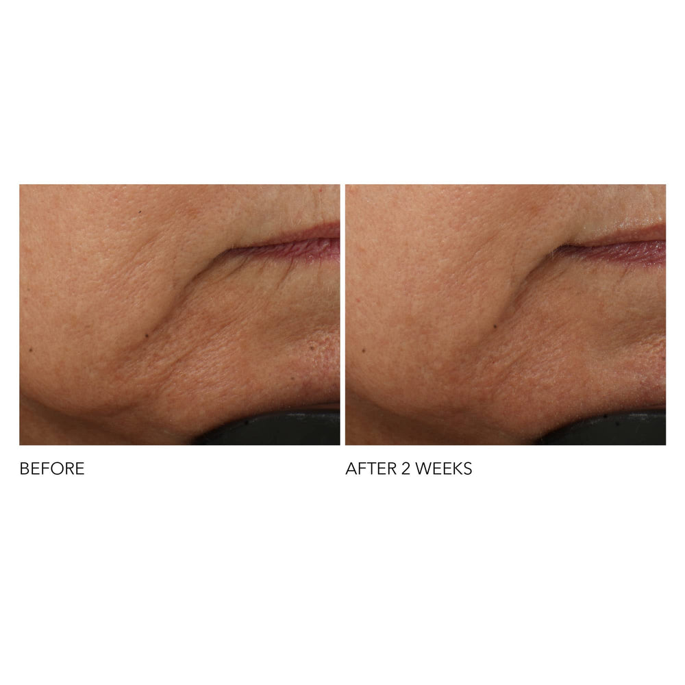 Application motion of Dr Dennis Gross Advanced Retinol Ferulic conveys gentle self care