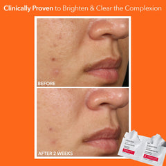 Aplicación Paso 1 en la piel para una exfoliación suave y precisa.