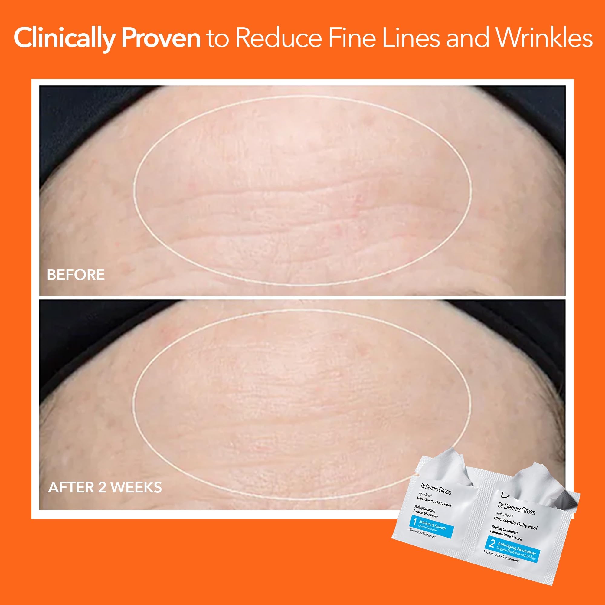 Dr. Dennis Gross Alpha Beta Ultra Gentle Daily Peel, reducción visual de poros con uso diario suave.