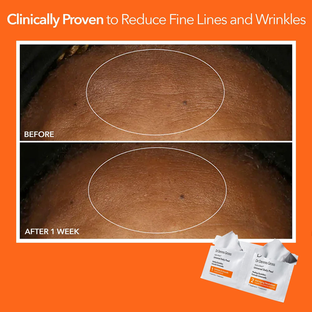 Dr Dennis Gross Alpha Beta Universal Daily Peel in a morning routine.