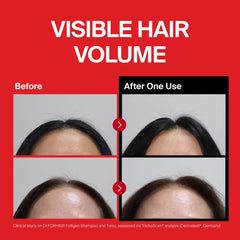 DR.FORHAIR Folligen Shampoo label closeup highlights sulfate-free formula for sensitive scalps.