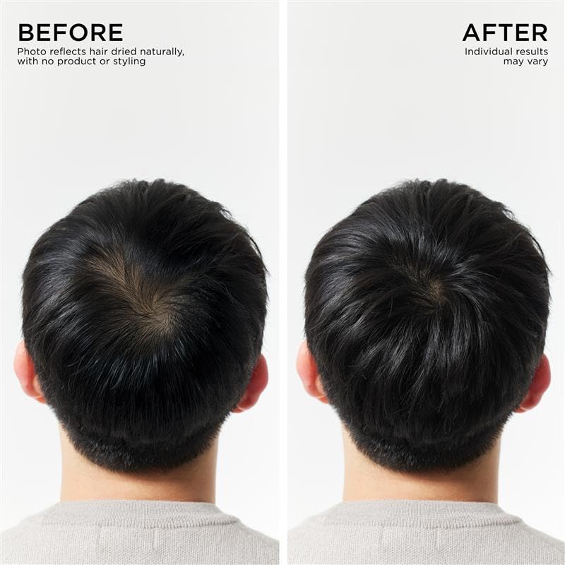 Capsulated prebiotics close-up emphasizing balanced scalp care.