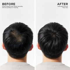 Capsulated prebiotics close-up emphasizing balanced scalp care.