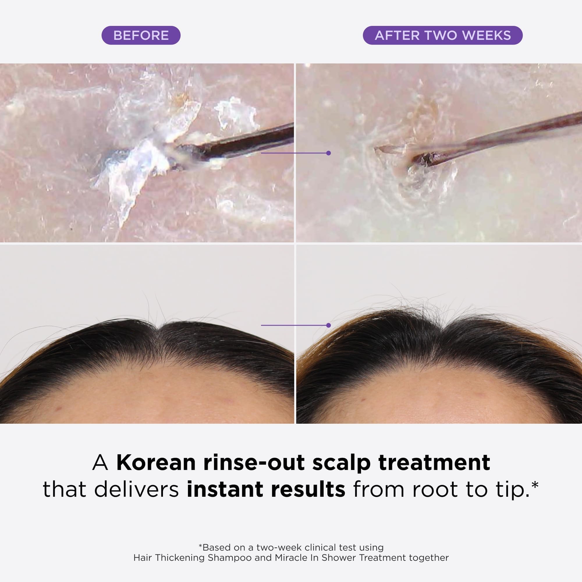 Dr. Groot Miracle In Shower Treatment tube exfoliates and nourishes the scalp.