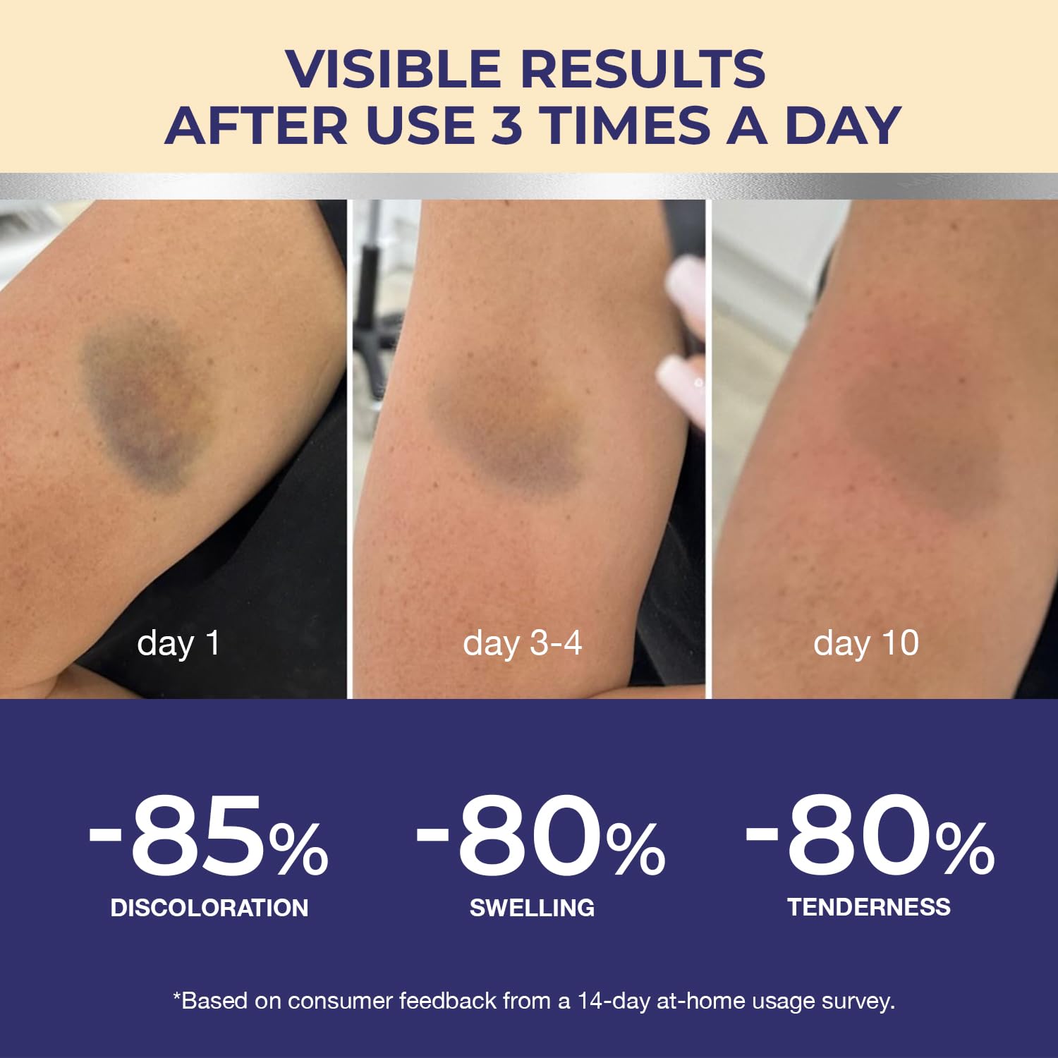 Dr. Luke Arnica soothing post-impact skin to reduce swelling and redness.