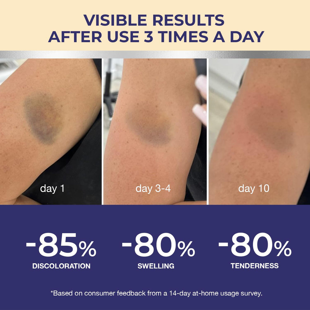 Dr. Luke Arnica soothing post-impact skin to reduce swelling and redness.