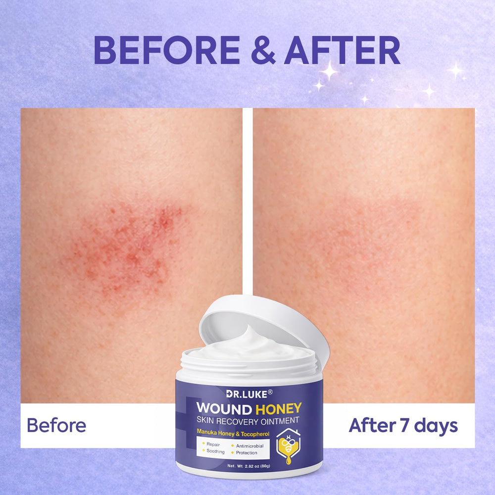 Dr. Luke Miel de Manuka Wound Gel sin residuo pegajoso.