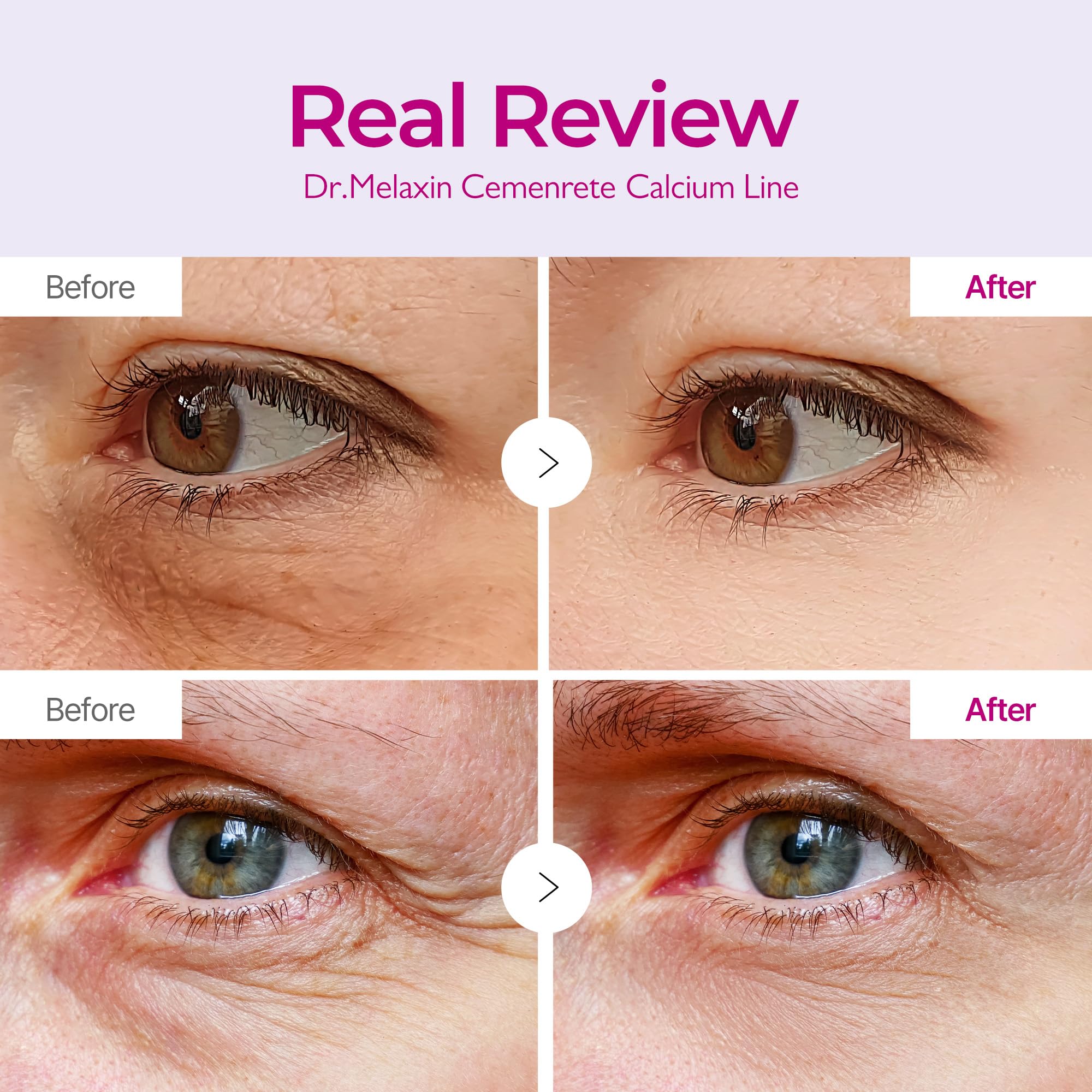 Dr.Melaxin Cemenrete calcium eye patch forehead-area provides targeted hydration for a smoother look