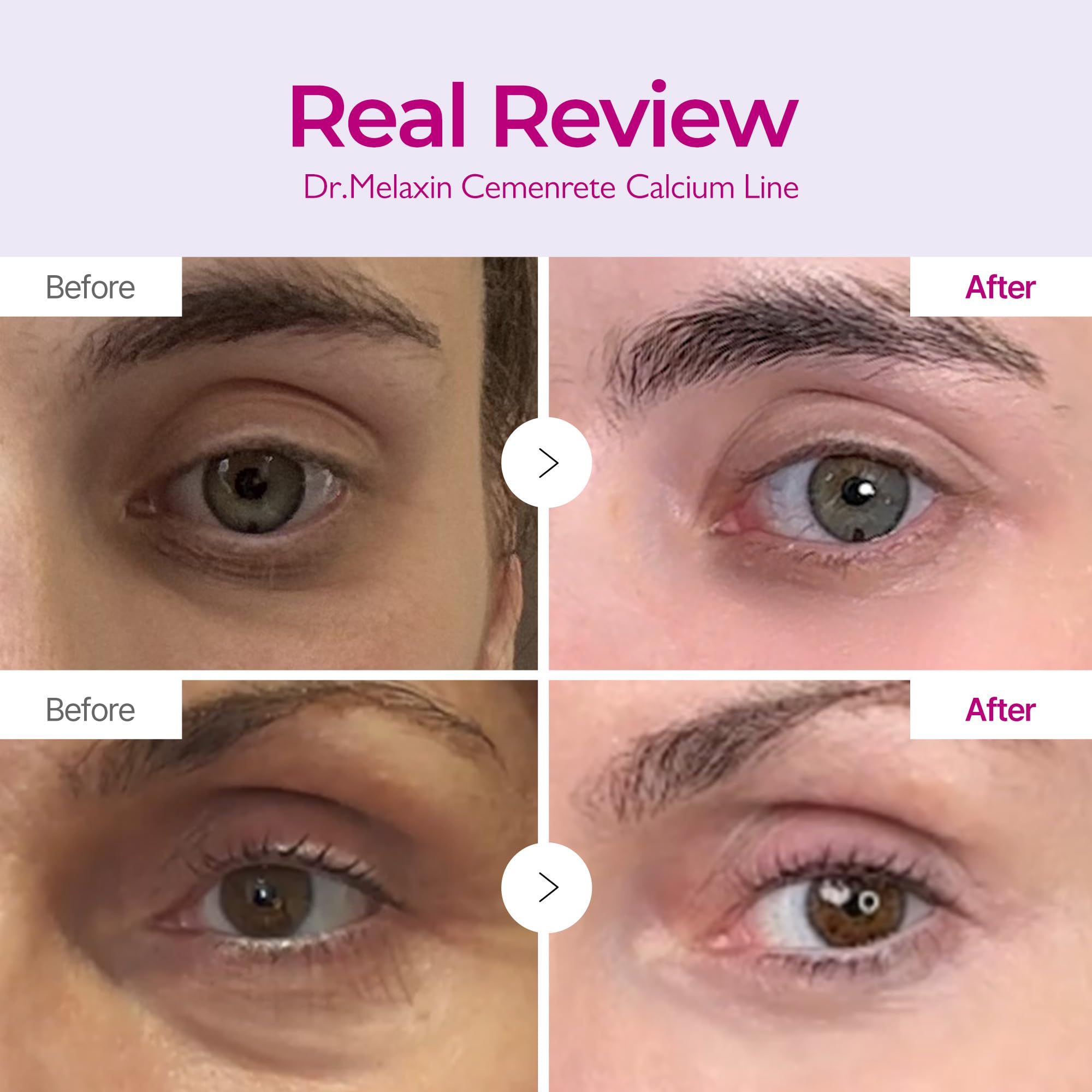 Eye area application with Dr.Melaxin Cemenrete suggesting smoothing action