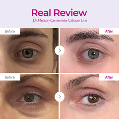 Eye area application with Dr.Melaxin Cemenrete suggesting smoothing action